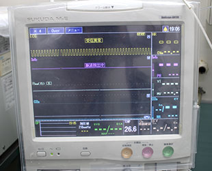 心電図モニター（ECG）